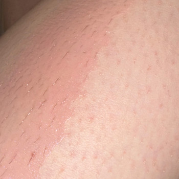 Фото с портфолио Sugaring silky skin lviv