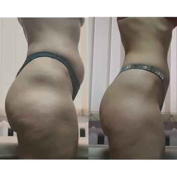 Фото с портфолио Майстерня краси та здоров'я SLIM