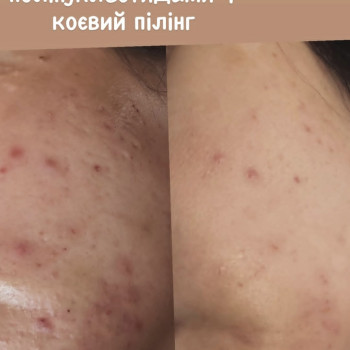 Фото с портфолио Олеся - Олеся Новохацкая
