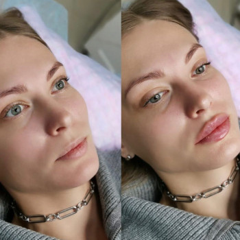 Фото с портфолио Валерія Миколаївна Міщенко