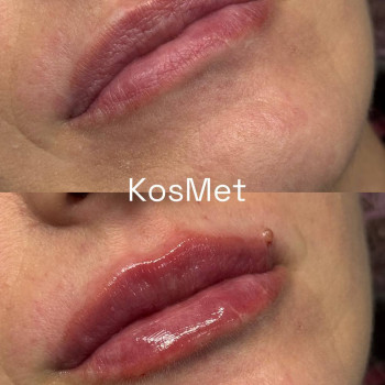 Фото с портфолио КОСМЕТ
