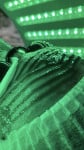 Карбоксітерапія для жирної шкіри з висипаннями Косметолог-естетист Анастасия Дніпро