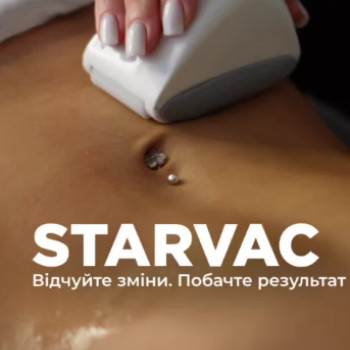 Фото с портфолио Шалена Краса