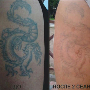 Фото с портфолио TattooDim
