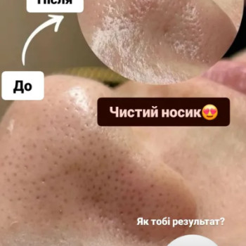 Фото с портфолио Анна Страшко