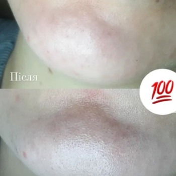 Фото с портфолио Анна Страшко