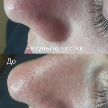 Фото с портфолио Анна Страшко