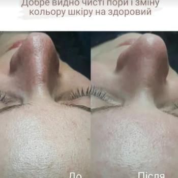 Фото с портфолио Анна Страшко