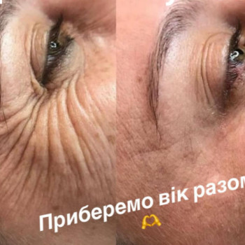 Фото с портфолио Виктория Щербань