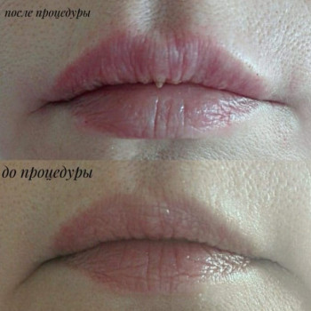 Фото с портфолио Татьяна Мироненко