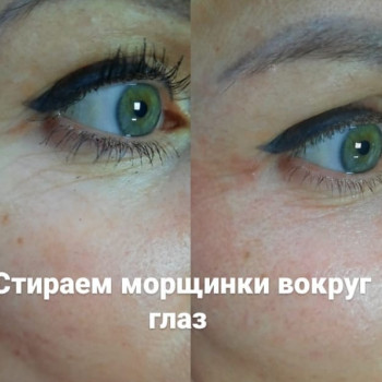 Фото с портфолио Татьяна Мироненко