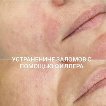 Фото с портфолио Татьяна Мироненко