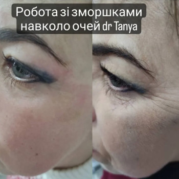 Фото с портфолио Татьяна Мироненко