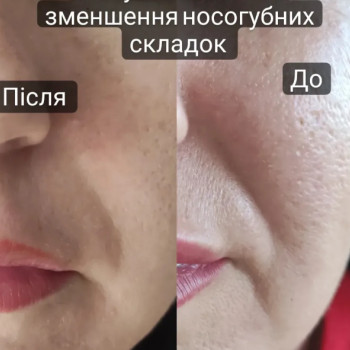 Фото с портфолио Татьяна Мироненко