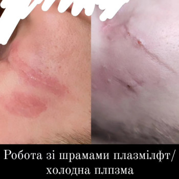 Фото с портфолио Татьяна Мироненко