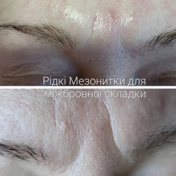 Фото с портфолио Татьяна Мироненко
