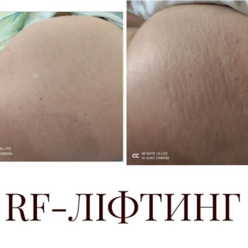 Фото с портфолио Людмила Азарова