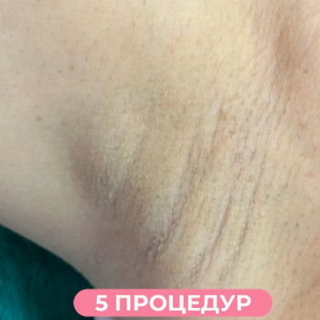 Фото с портфолио Only Girls