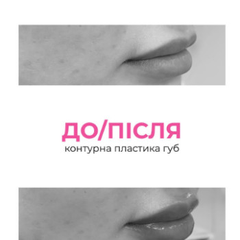 Фото с портфолио Only Girls