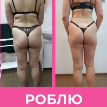 Фото с портфолио Only Girls