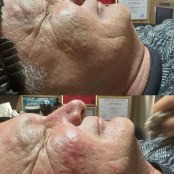 Фото с портфолио Asaulenko Clinic