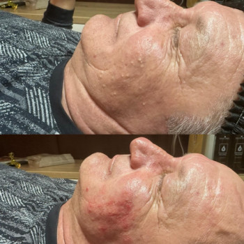 Фото с портфолио Asaulenko Clinic