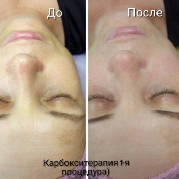 Фото с портфолио Екатерина Пинчук