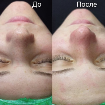 Фото с портфолио Екатерина Пинчук