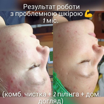 Фото с портфолио Екатерина Пинчук