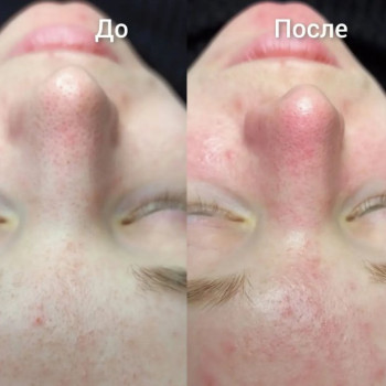 Фото с портфолио Екатерина Пинчук