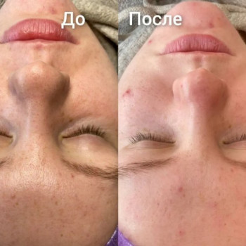 Фото с портфолио Екатерина Пинчук