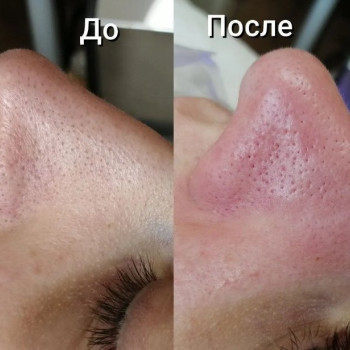 Фото с портфолио Екатерина Пинчук