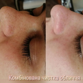 Фото с портфолио Екатерина Пинчук