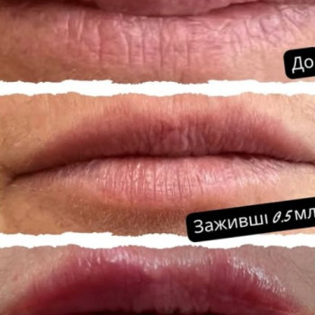 Фото с портфолио Екатерина Пинчук