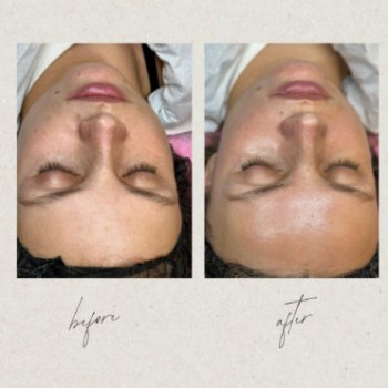 Фото с портфолио Dr. Gomon Cosmetology