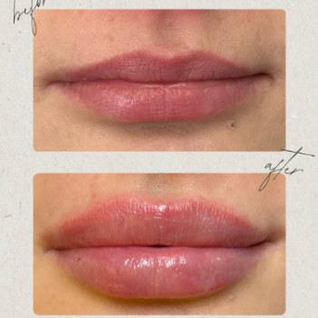 Фото с портфолио Dr. Gomon Cosmetology