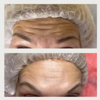 Фото с портфолио Dr. Gomon Cosmetology