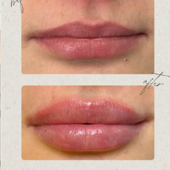 Фото с портфолио Dr. Gomon Cosmetology
