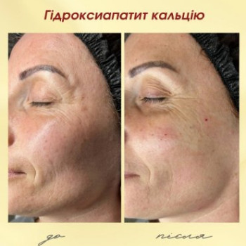 Фото с портфолио Dr. Gomon Cosmetology