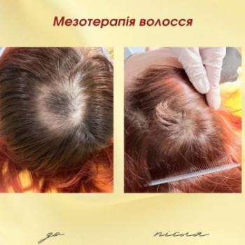 Фото с портфолио Dr. Gomon Cosmetology