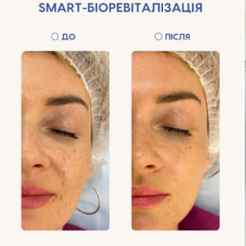 Фото с портфолио Dr. Gomon Cosmetology