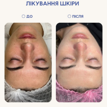 Фото с портфолио Dr. Gomon Cosmetology