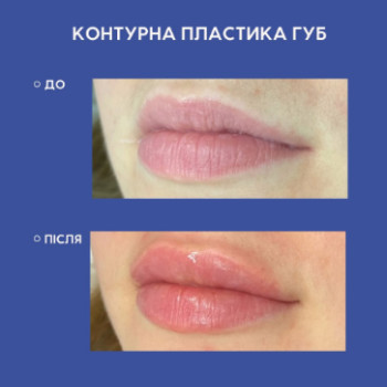 Фото с портфолио Dr. Gomon Cosmetology