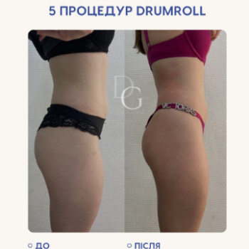 Фото с портфолио Dr. Gomon Cosmetology