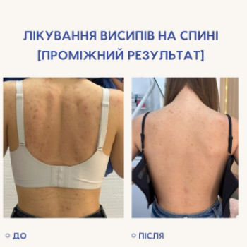 Фото с портфолио Dr. Gomon Cosmetology