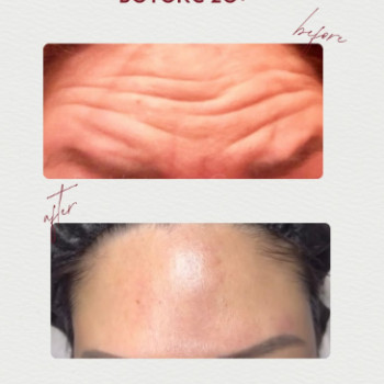 Фото с портфолио Dr. Gomon Cosmetology