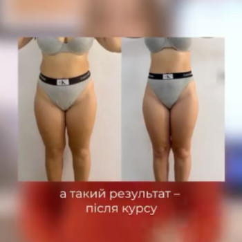 Фото с портфолио Dr. Gomon Cosmetology
