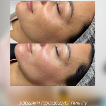 Фото с портфолио Dr. Gomon Cosmetology
