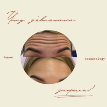 Фото с портфолио Dr. Gomon Cosmetology