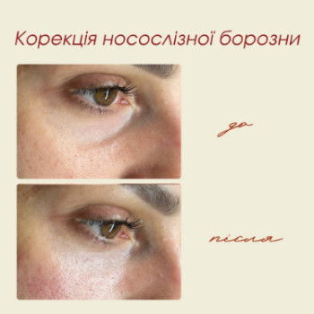 Фото с портфолио Dr. Gomon Cosmetology